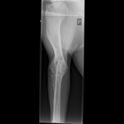 Roentgenbild Lena